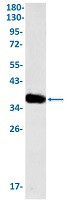 TNFRSF10D Antibody in Western Blot (WB)