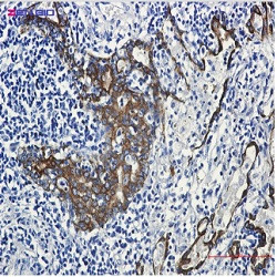 KRT7 Antibody in Immunohistochemistry (Paraffin) (IHC (P))