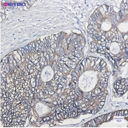 KRT19 Antibody in Immunohistochemistry (Paraffin) (IHC (P))