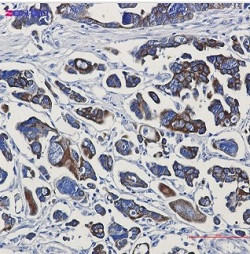 KRT18 Antibody in Immunohistochemistry (Paraffin) (IHC (P))