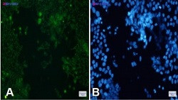 CYP17A1 Antibody in Immunocytochemistry (ICC/IF)