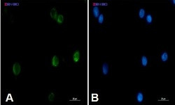 CYCS Antibody in Immunocytochemistry (ICC/IF)