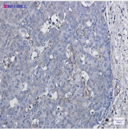 CYP1B1 Antibody in Immunohistochemistry (Paraffin) (IHC (P))