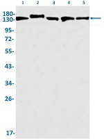 CYFIP1 Antibody in Western Blot (WB)