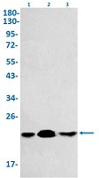 PPIB Antibody in Western Blot (WB)