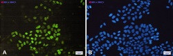 CCNE2 Antibody in Immunocytochemistry (ICC/IF)