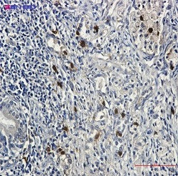 CCNE2 Antibody in Immunohistochemistry (Paraffin) (IHC (P))