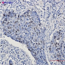 CCNA2 Antibody in Immunohistochemistry (Paraffin) (IHC (P))