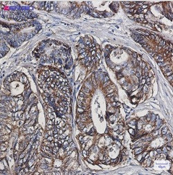 HSPE1 Antibody in Immunohistochemistry (Paraffin) (IHC (P))