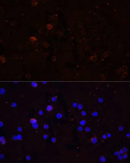 CD86 Antibody in Immunocytochemistry (ICC/IF)