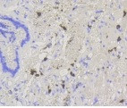 ABCG1 Antibody in Immunohistochemistry (Paraffin) (IHC (P))