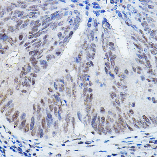 DGCR8 Antibody in Immunohistochemistry (Paraffin) (IHC (P))