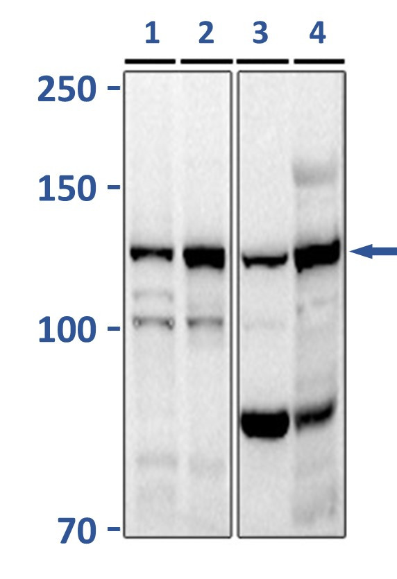 ATP-Citrate Lyase Antibody in Western Blot (WB)