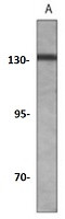 TRK B Antibody in Western Blot (WB)