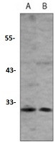 CD273 Antibody in Western Blot (WB)