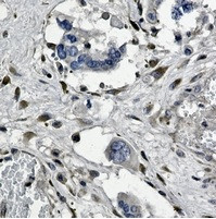 GNB2 Antibody in Immunohistochemistry (Paraffin) (IHC (P))
