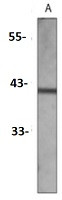 AT1 Antibody in Western Blot (WB)