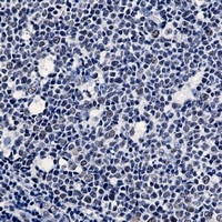 WTAP Antibody in Immunohistochemistry (Paraffin) (IHC (P))
