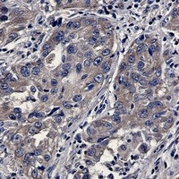 BAX Antibody in Immunohistochemistry (Paraffin) (IHC (P))