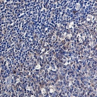 CASP3 Antibody in Immunohistochemistry (Paraffin) (IHC (P))