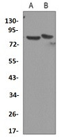 CHUK Antibody in Western Blot (WB)
