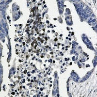 GSK3B Antibody in Immunohistochemistry (Paraffin) (IHC (P))