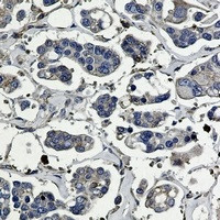 ARPC5 Antibody in Immunohistochemistry (Paraffin) (IHC (P))