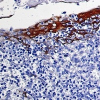 KRT10 Antibody in Immunohistochemistry (Paraffin) (IHC (P))