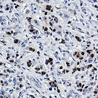 SOX9 Antibody in Immunohistochemistry (Paraffin) (IHC (P))