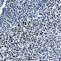 Phospho-NFE2L2 (Ser40) Antibody in Immunohistochemistry (Paraffin) (IHC (P))