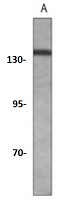 Phospho-RBL2 (Thr986) Antibody in Western Blot (WB)