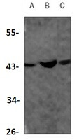 ACADS Antibody in Western Blot (WB)