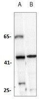 ACAT1 Antibody in Western Blot (WB)