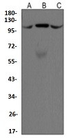PDCD6IP Antibody in Western Blot (WB)