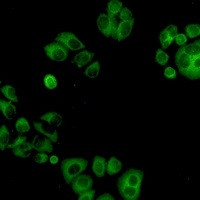 ALPL Antibody in Immunocytochemistry (ICC/IF)