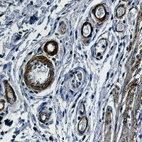 ACTA2 Antibody in Immunohistochemistry (Paraffin) (IHC (P))