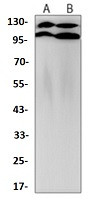 APOER2 Antibody in Western Blot (WB)