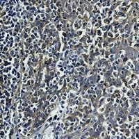 TUBB Antibody in Immunohistochemistry (Paraffin) (IHC (P))