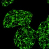 PRKACA Antibody in Immunocytochemistry (ICC/IF)