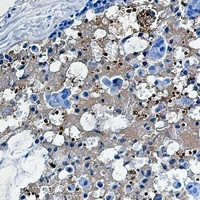 CAT Antibody in Immunohistochemistry (Paraffin) (IHC (P))
