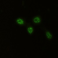 CHEK2 Antibody in Immunocytochemistry (ICC/IF)