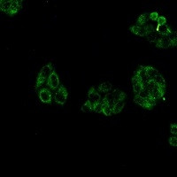 COL3A1 Antibody in Immunocytochemistry (ICC/IF)