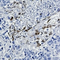 PTGS2 Antibody in Immunohistochemistry (Paraffin) (IHC (P))