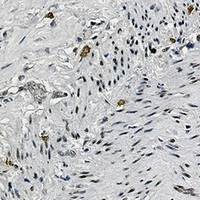 Phospho-CREB1 (Ser133) Antibody in Immunohistochemistry (Paraffin) (IHC (P))