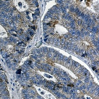 CTNND1 Antibody in Immunohistochemistry (Paraffin) (IHC (P))