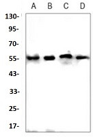 GSDME Antibody in Western Blot (WB)