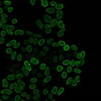 E2F1 Antibody in Immunocytochemistry (ICC/IF)