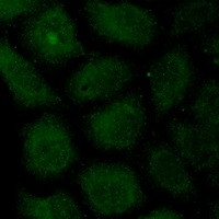 PTK2 Antibody in Immunocytochemistry (ICC/IF)