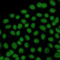 FTO Antibody in Immunocytochemistry (ICC/IF)