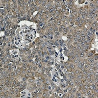 GRP78 Antibody in Immunohistochemistry (Paraffin) (IHC (P))